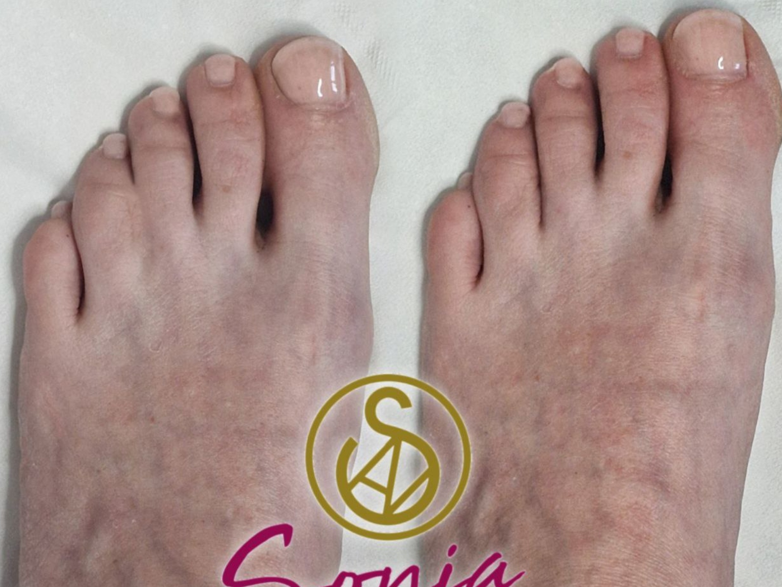 Pigmentazione realistica SINDATTILIA