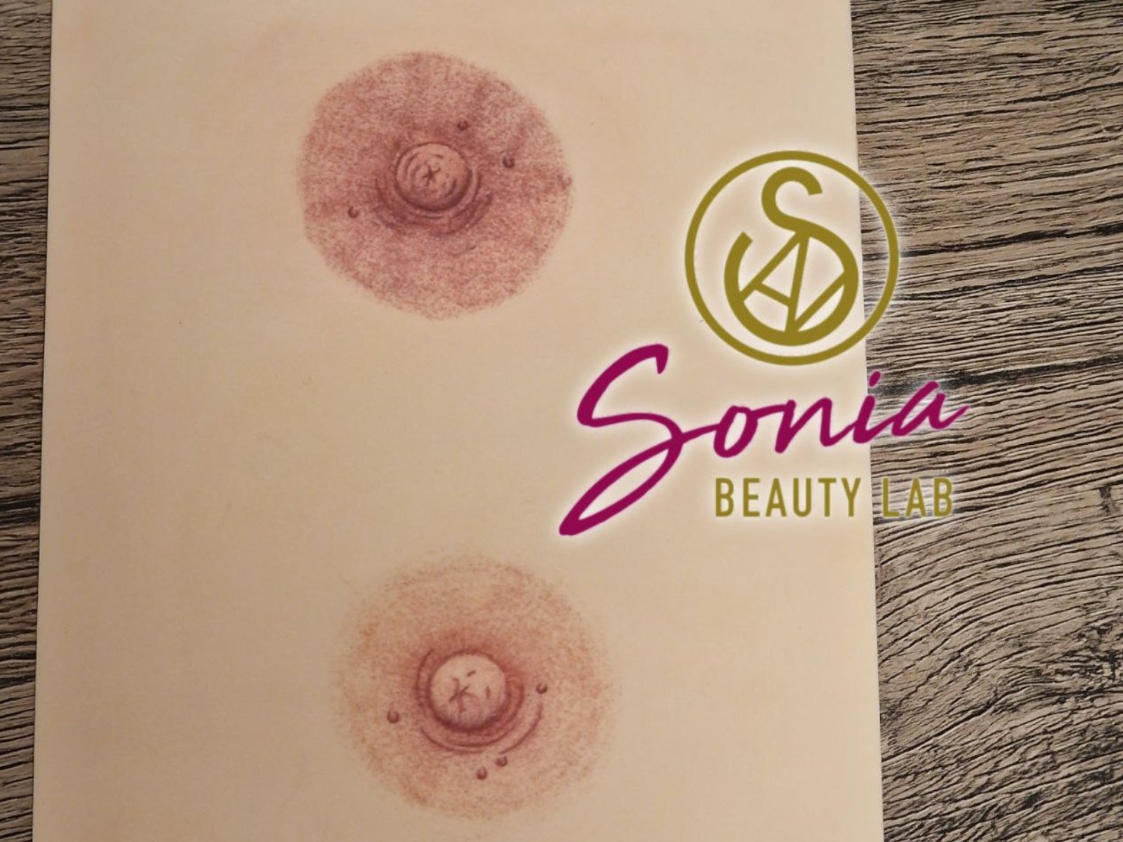 Pigmentazione AREOLA MAMMARIA